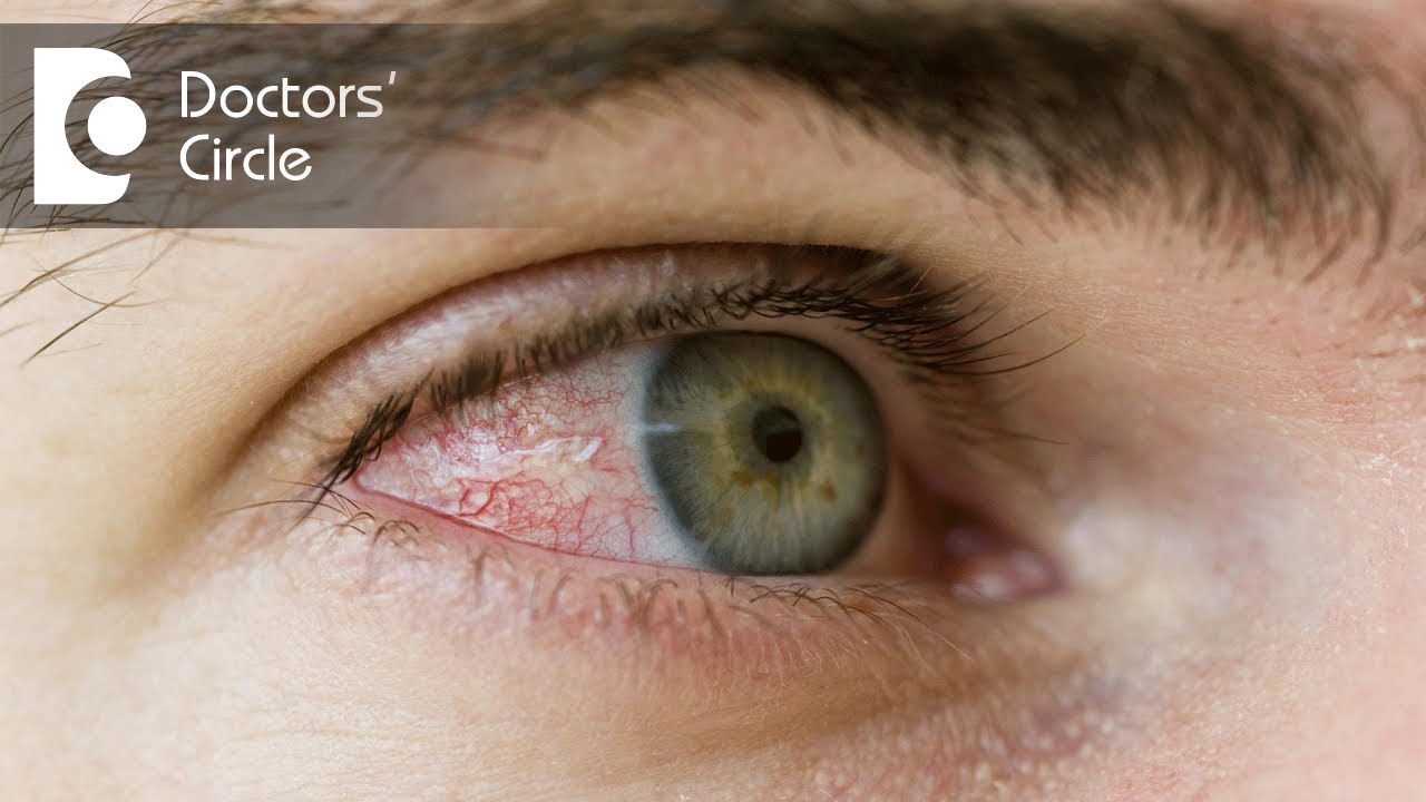 What happens if soap gets in your eye: main illustration