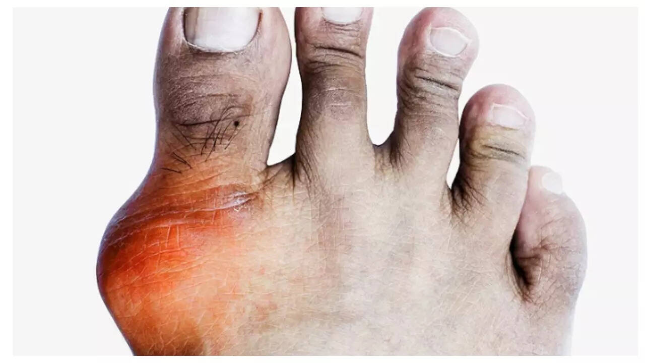What does it mean when uric acid is high: main illustration