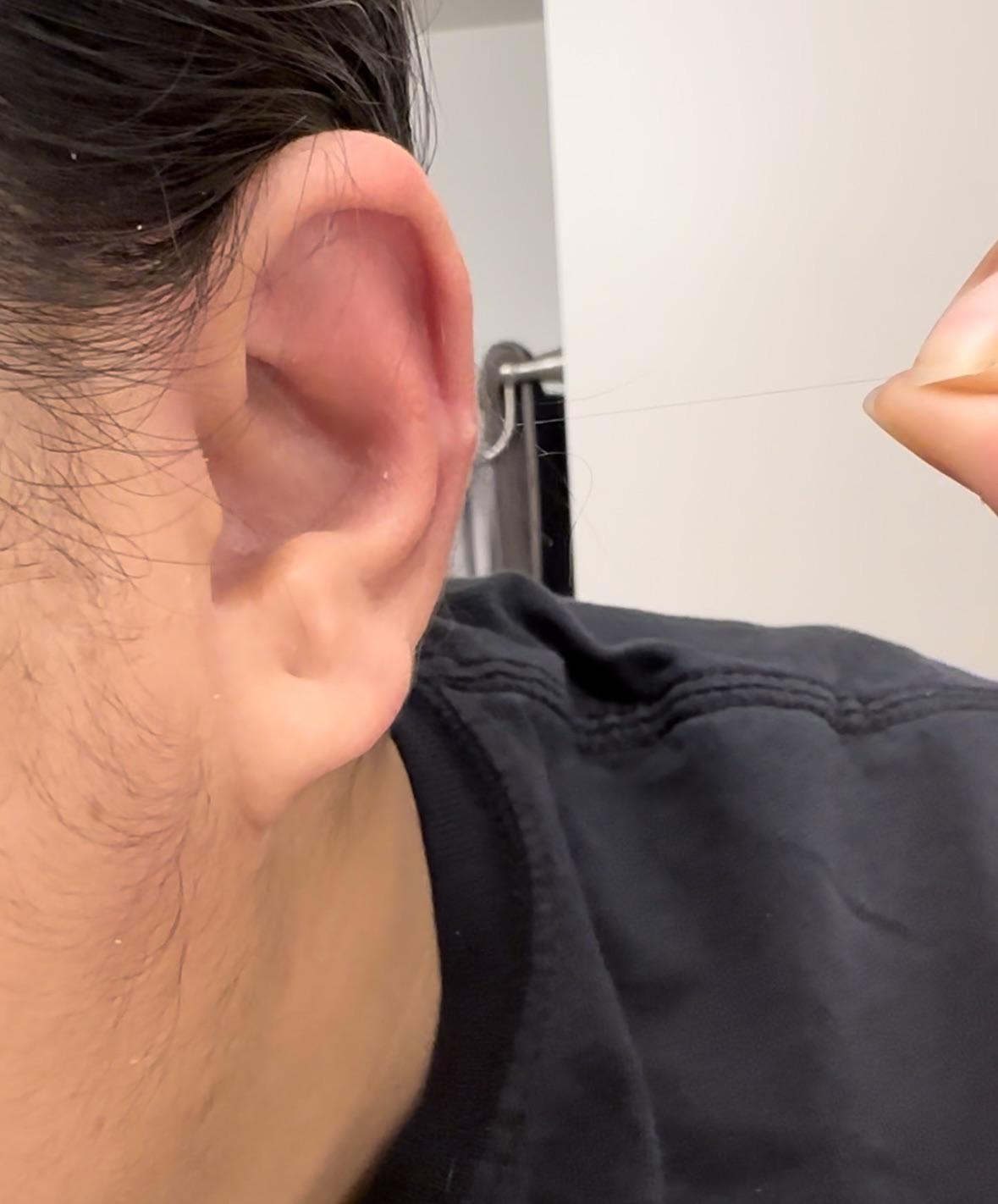 Why does ear hair grow: visual explanation