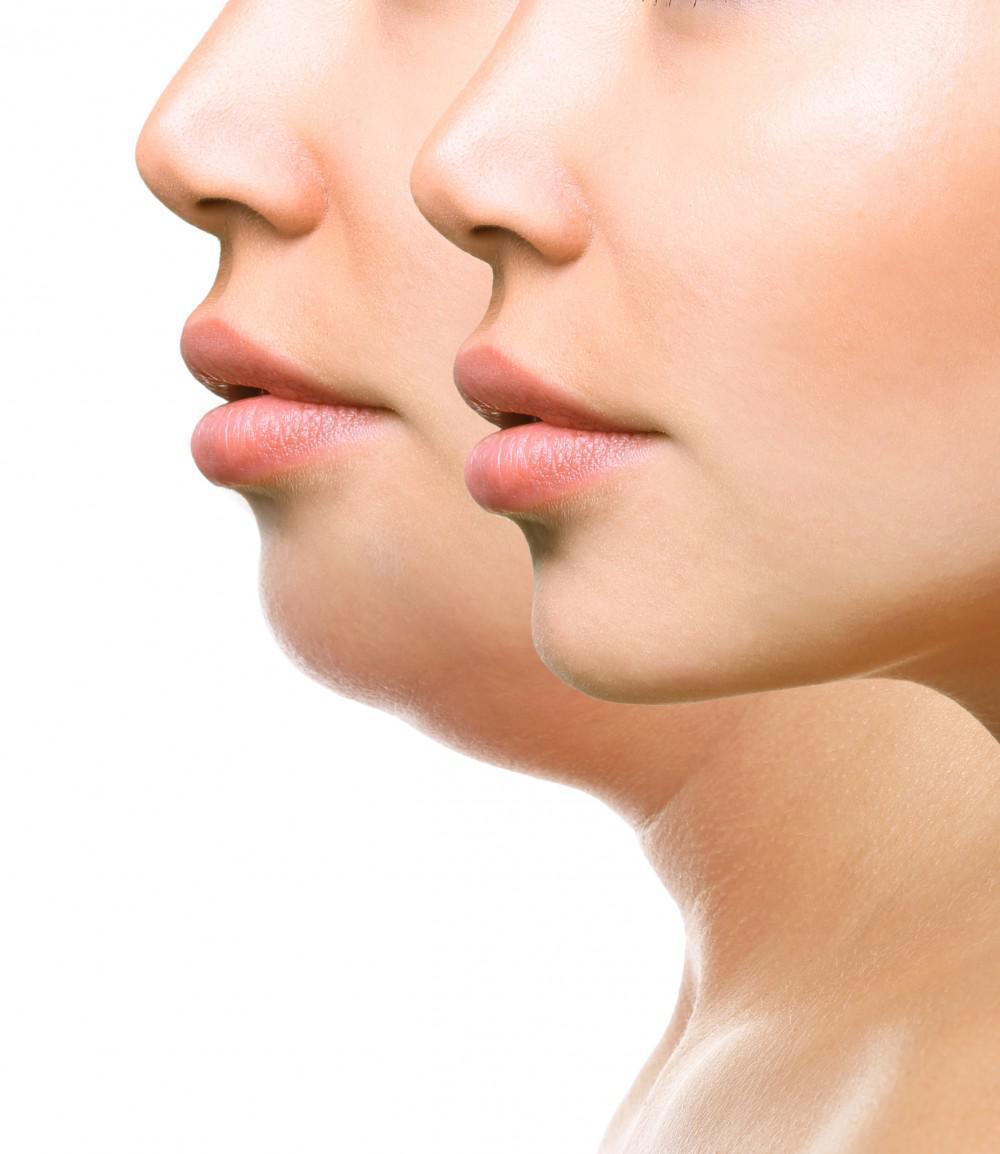 Why do i have double chin: main illustration