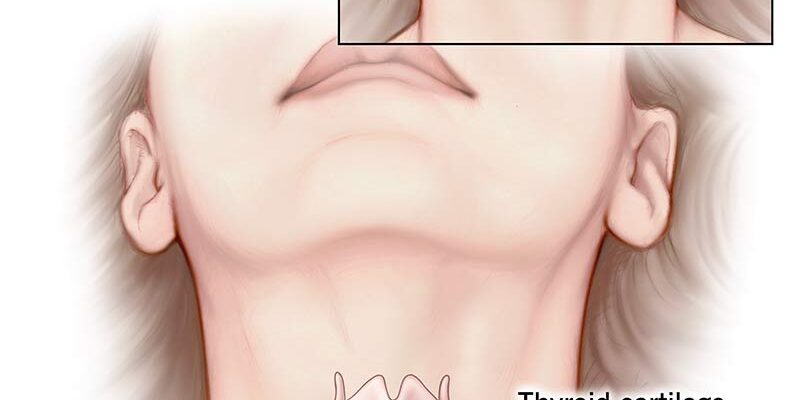 24656-adams-apple