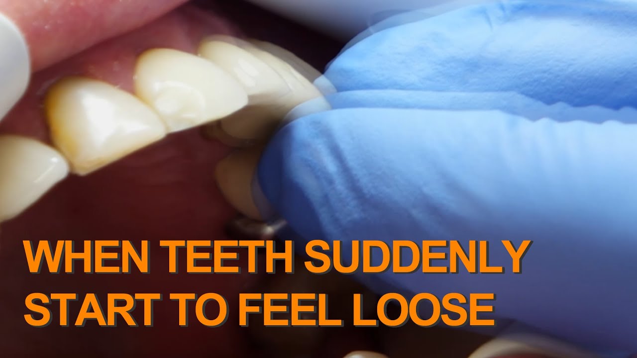 Why do my tooth feel loose: example and key details