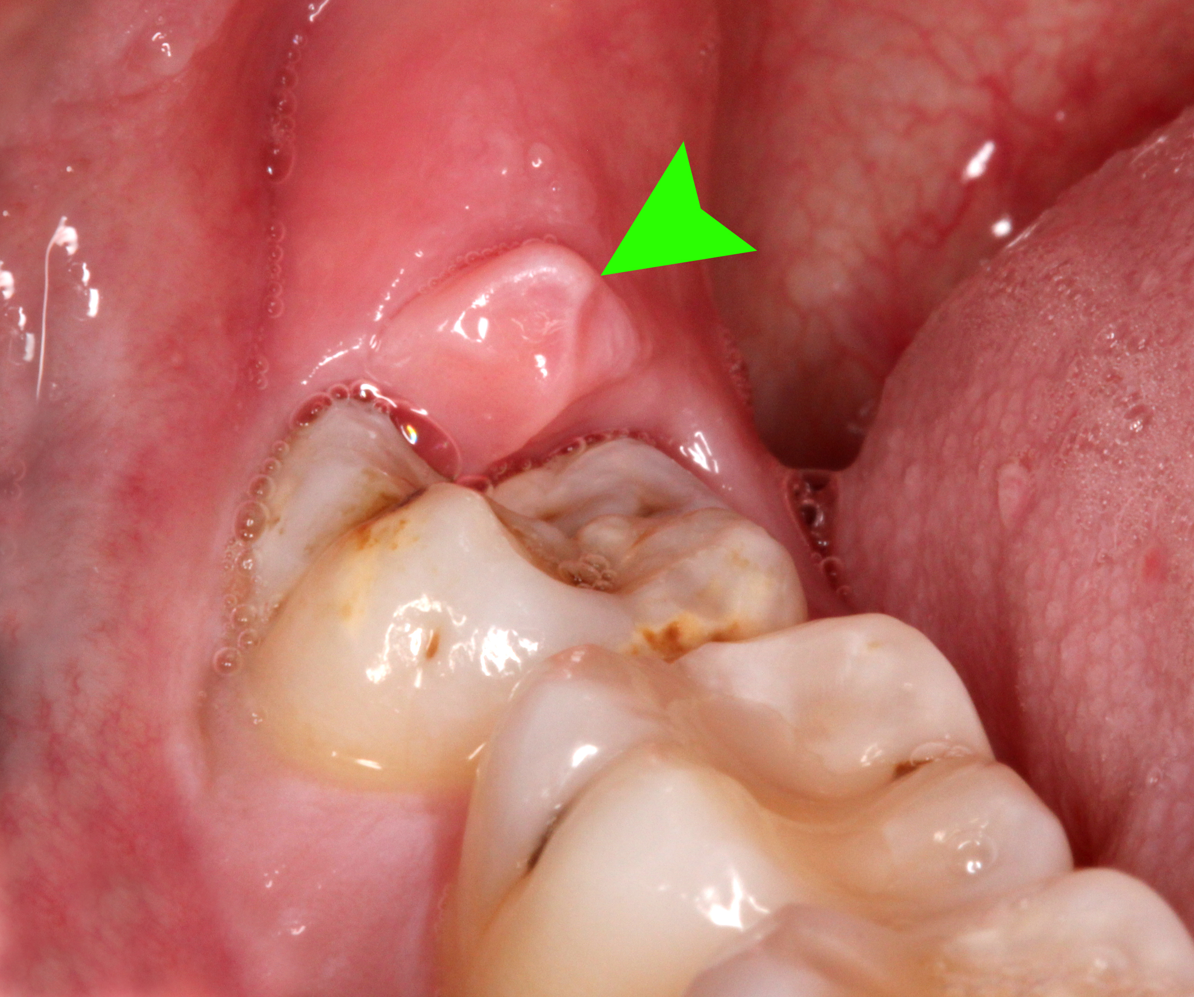 Why do my back gums hurt: main illustration