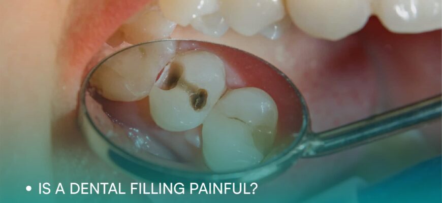 67b45291e796fdaea5837c5a_Is-a-dental-filling-painful