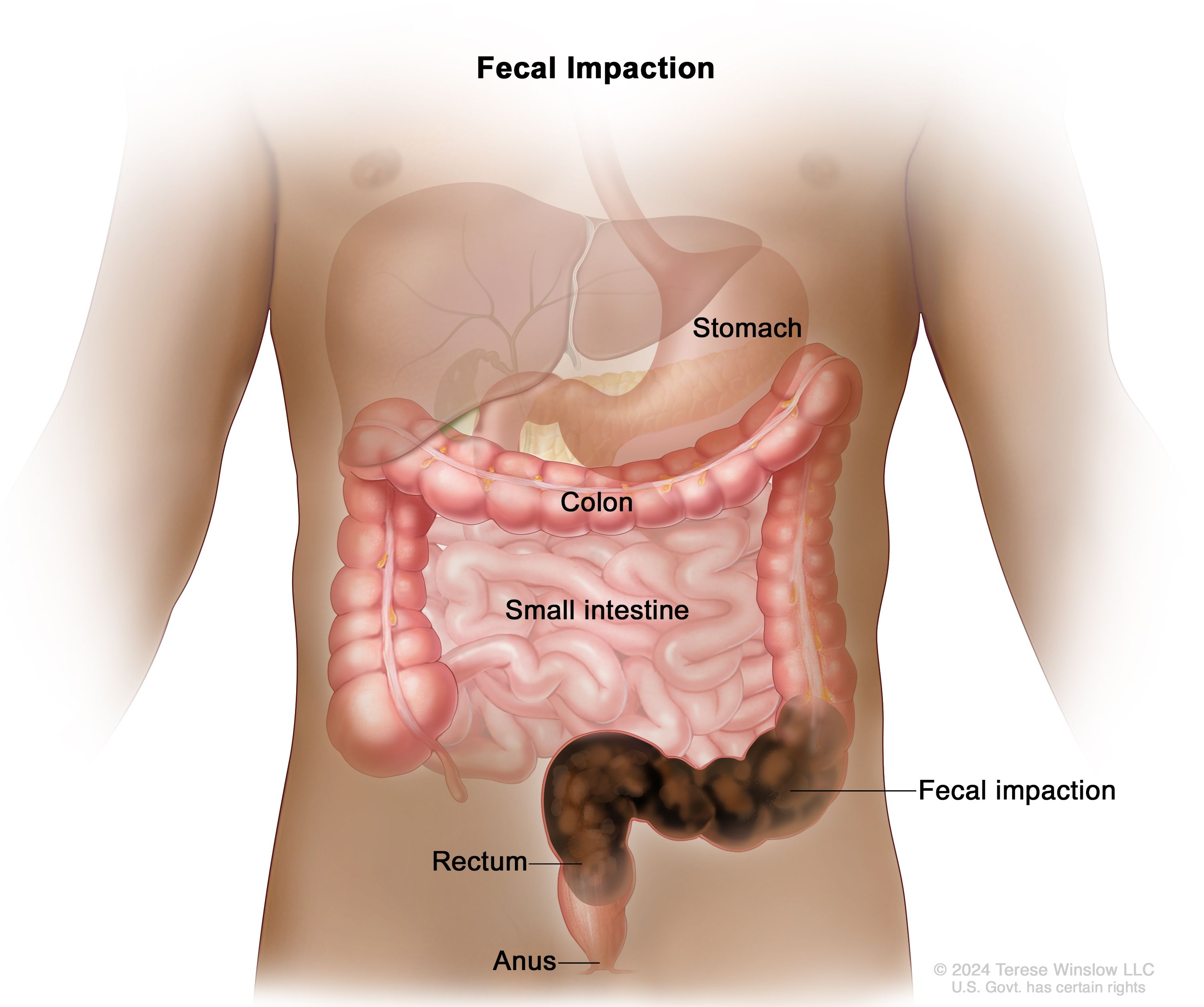 Why does constipation occur: main illustration
