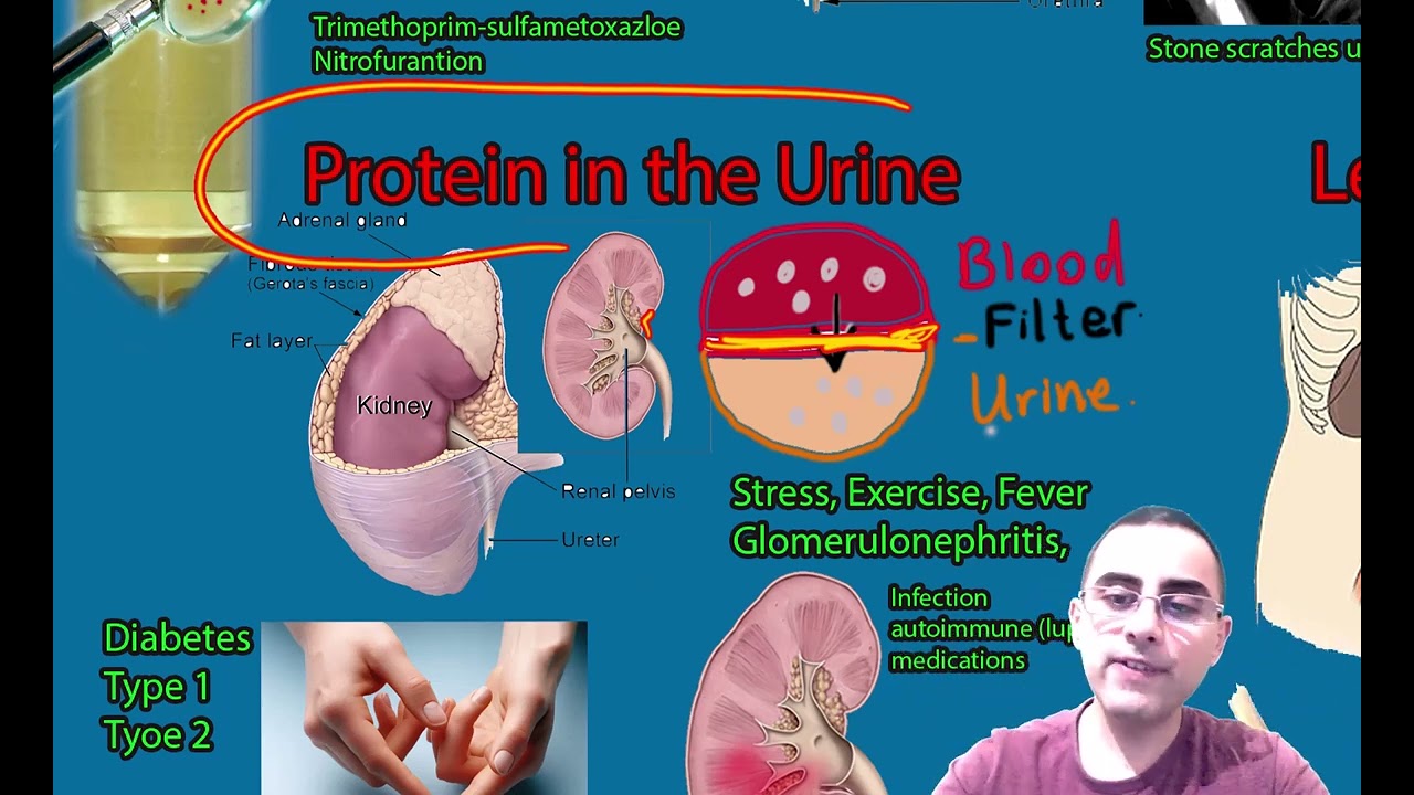 What does it mean protein in urine: example and key details