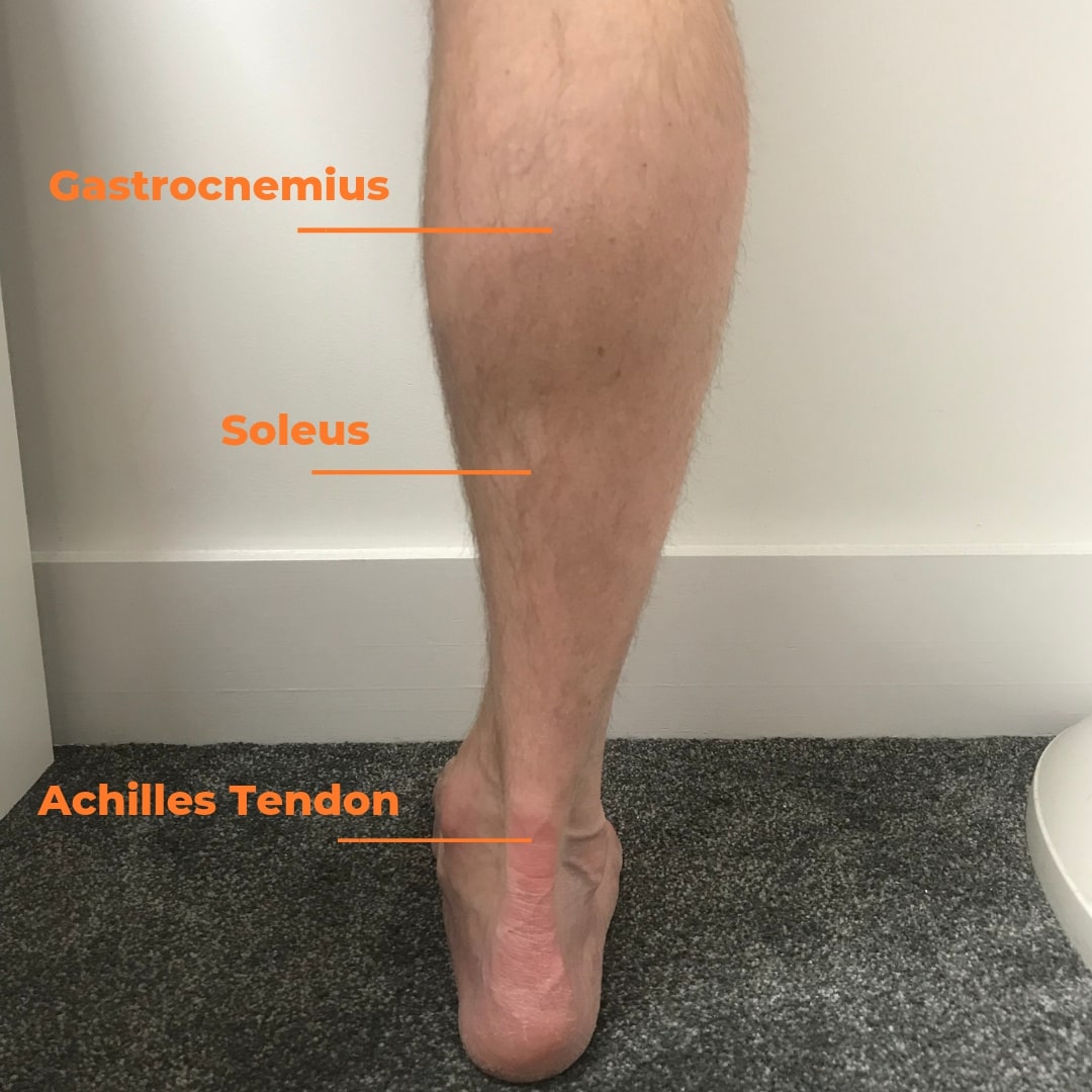 Why does my calf keep cramping: main illustration