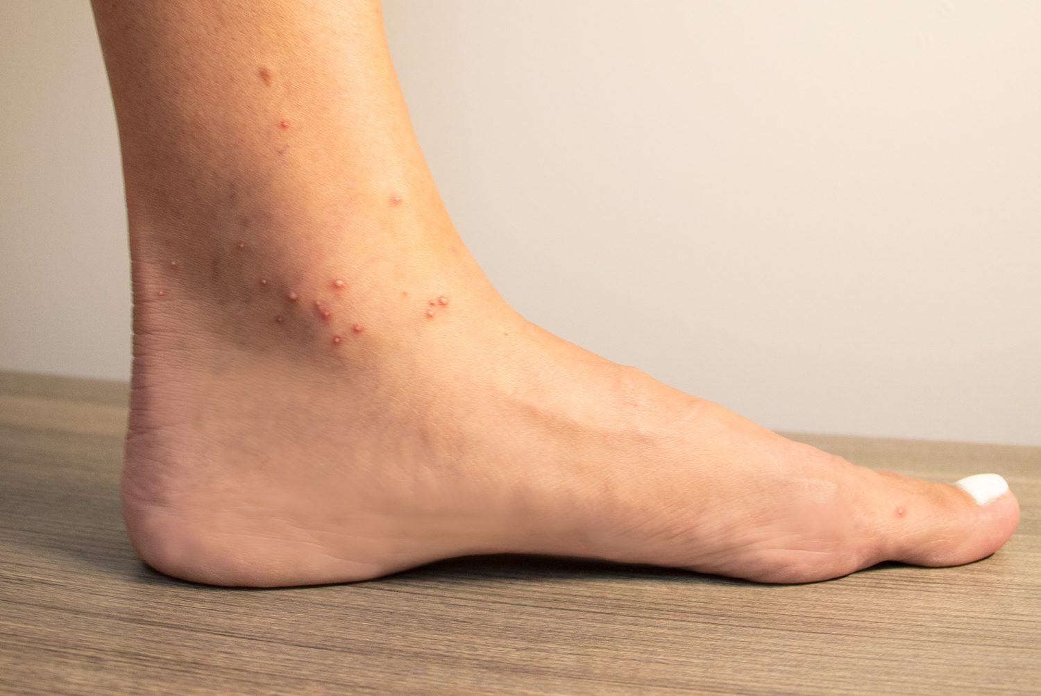 Can normal ants bite: main illustration