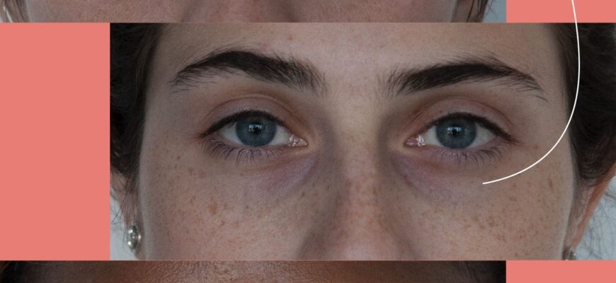 Artboard201SELF-dark-circles