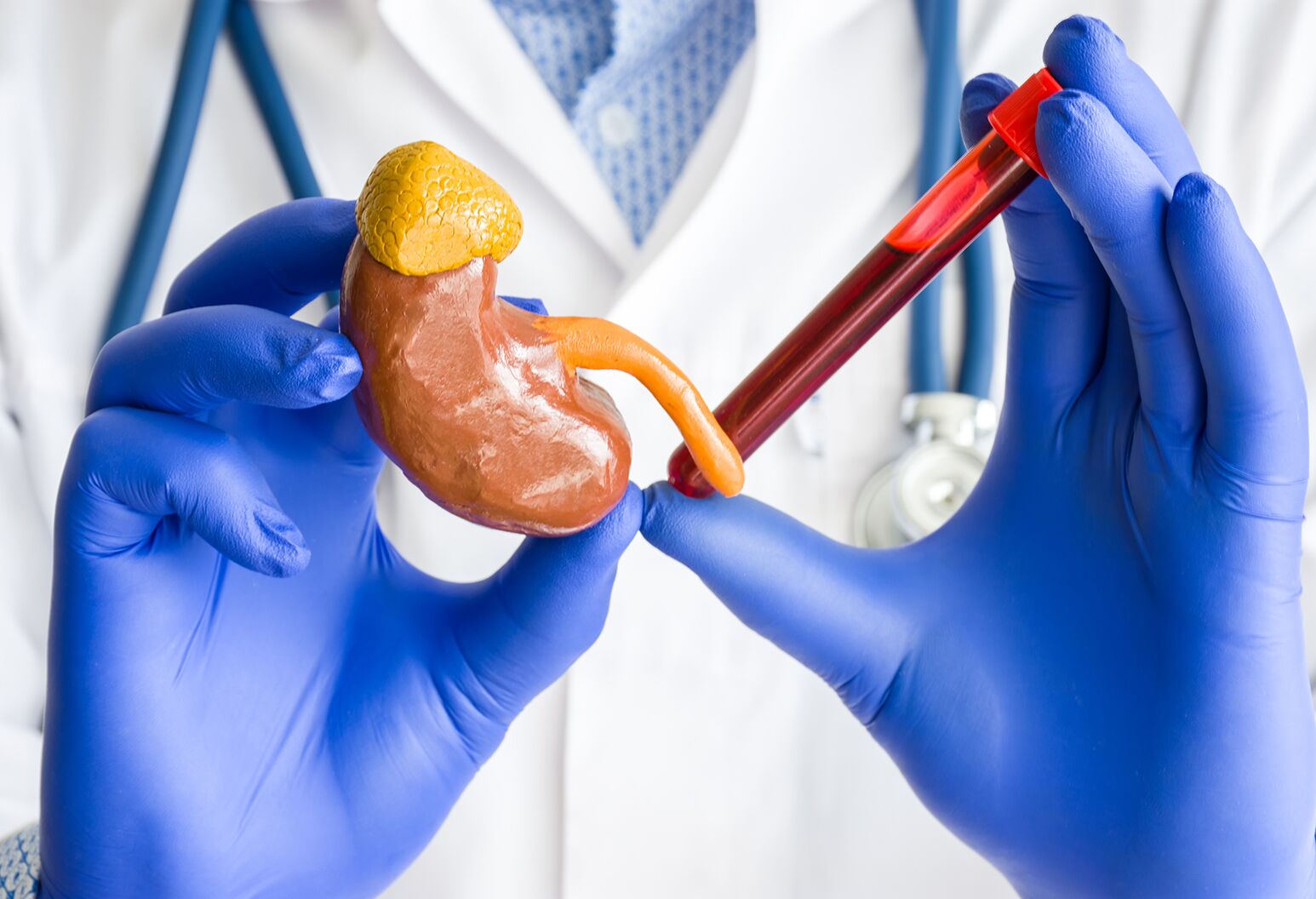 What does it mean if your creatinine is high: main illustration