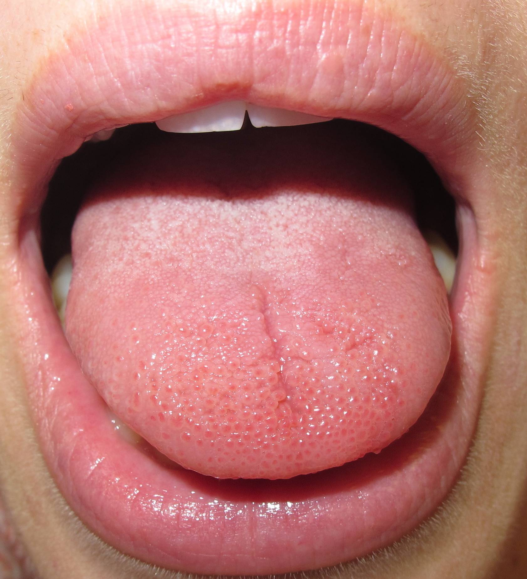 Why does my tongue feel burnt: main illustration