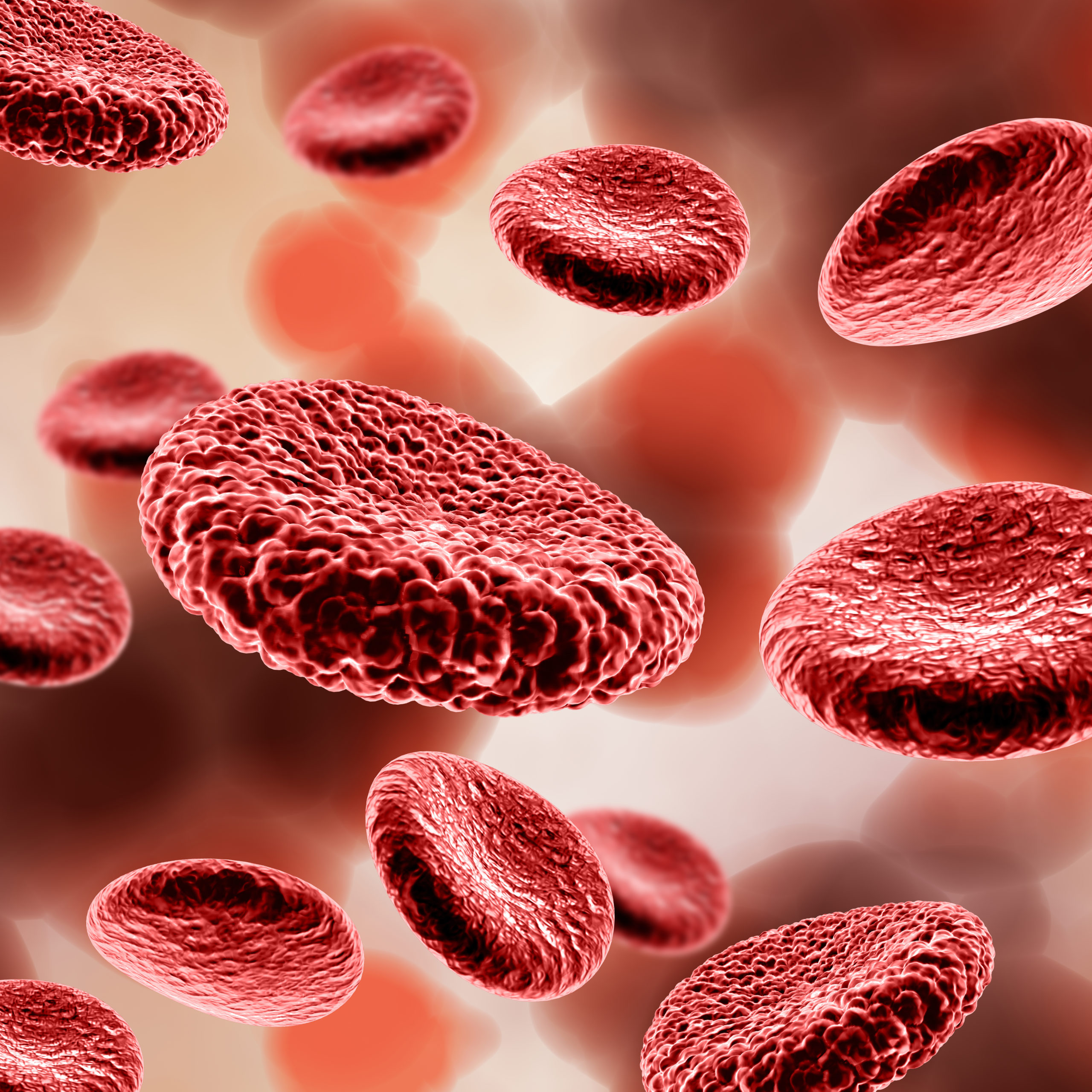 What causes red cell distribution width to be high: main illustration