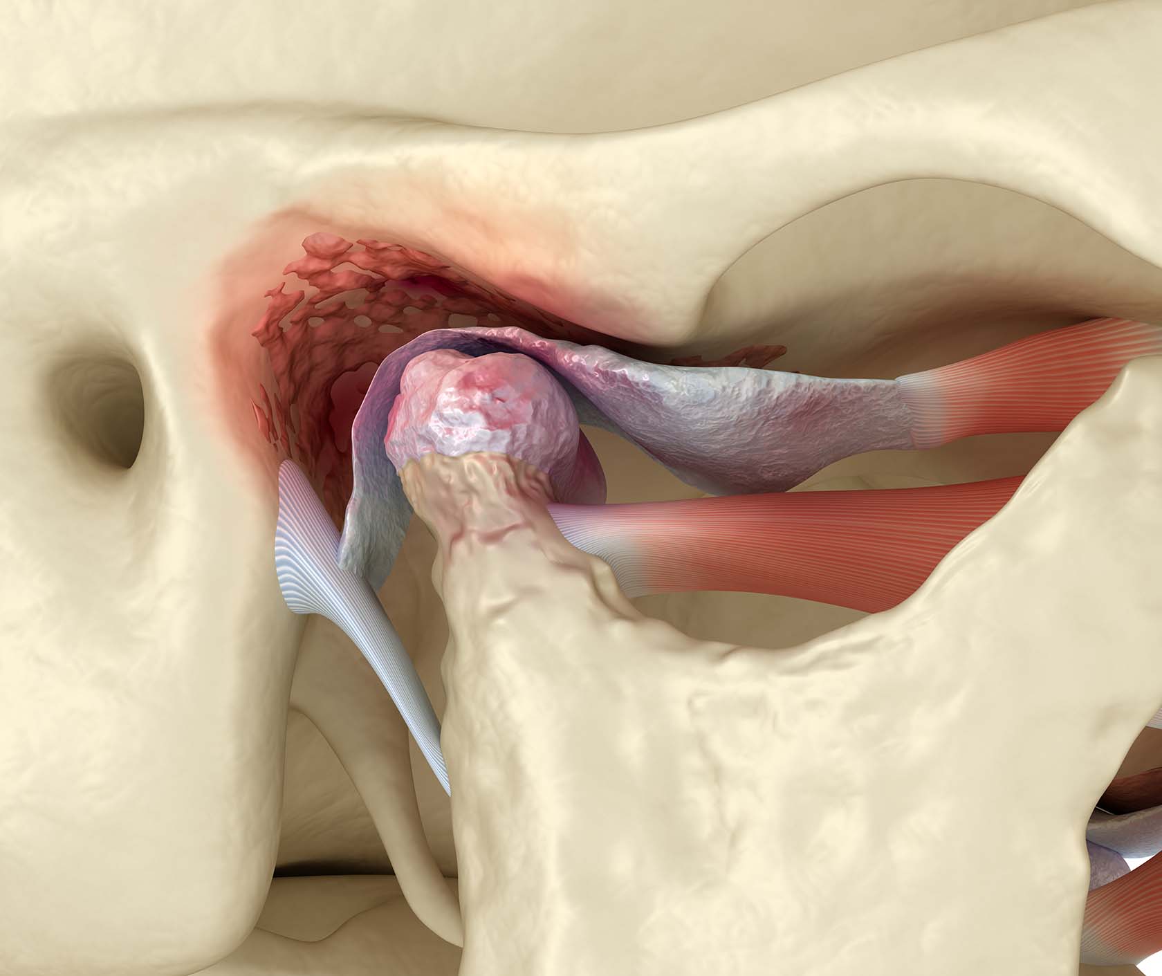 What causes popping in the jaw: main illustration