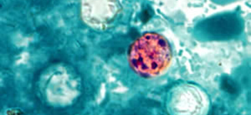 Microscopic-image-of-cyclospora-cayetanensis-the-parasite-that-causes-cyclosporiasis-CDC-copy