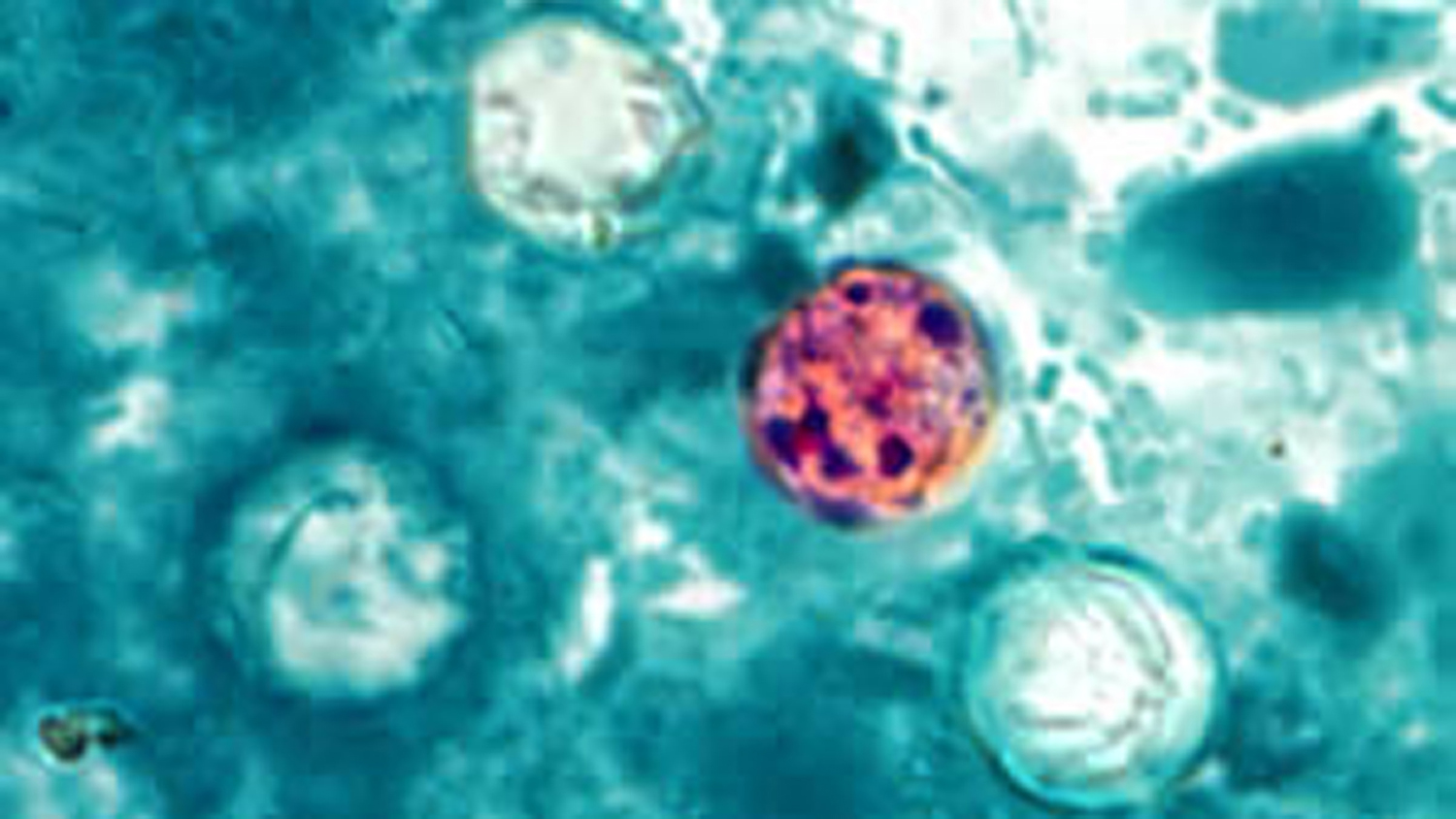 What to do if you have cyclospora: main illustration
