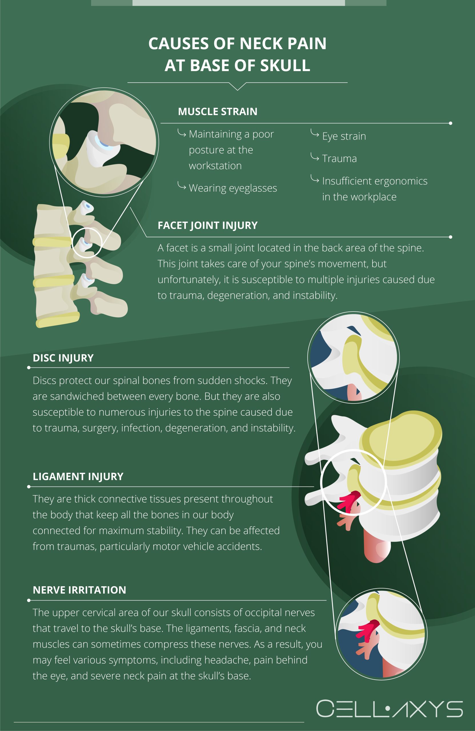 What causes left side of neck pain: example and key details