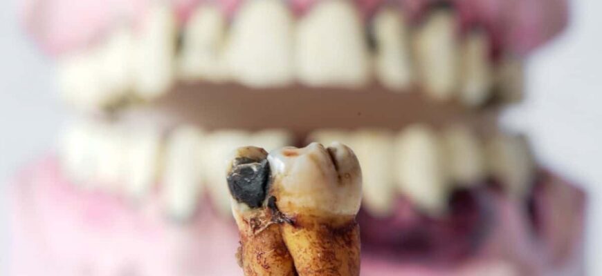 Smell-Cavities