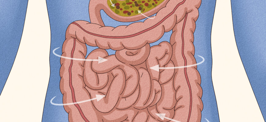 Stop Your Stomach From Growling Loudly In Class Step 1 Version 5 1 Scaled