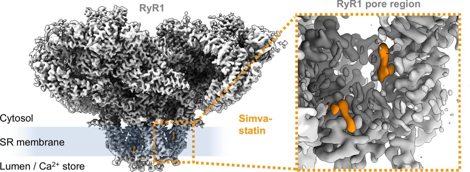 Why does statin cause muscle pain: visual explanation