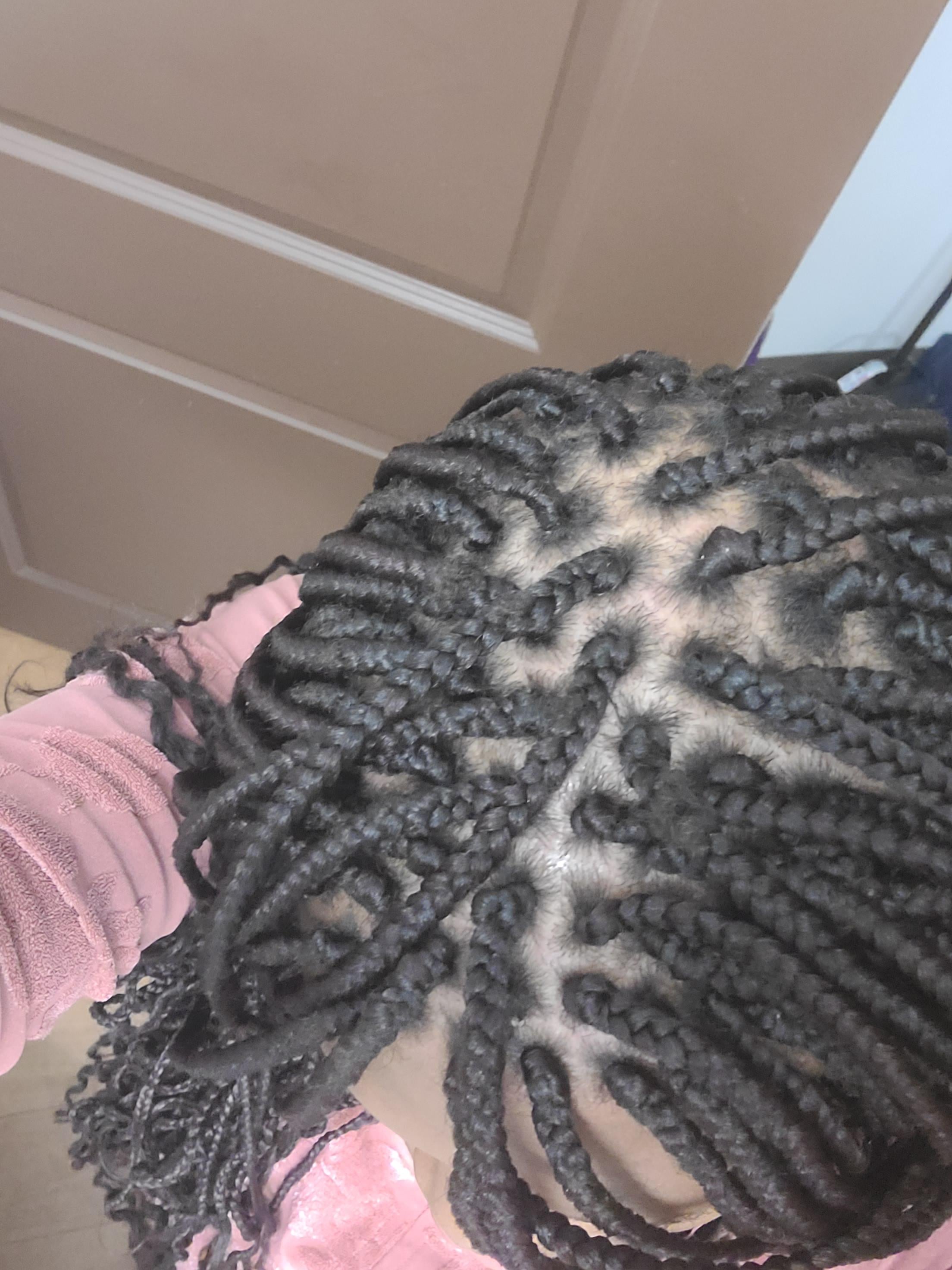 Why does braid itch: visual explanation