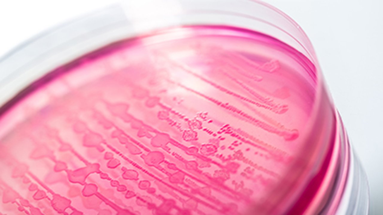 What causes e coli infection: visual explanation
