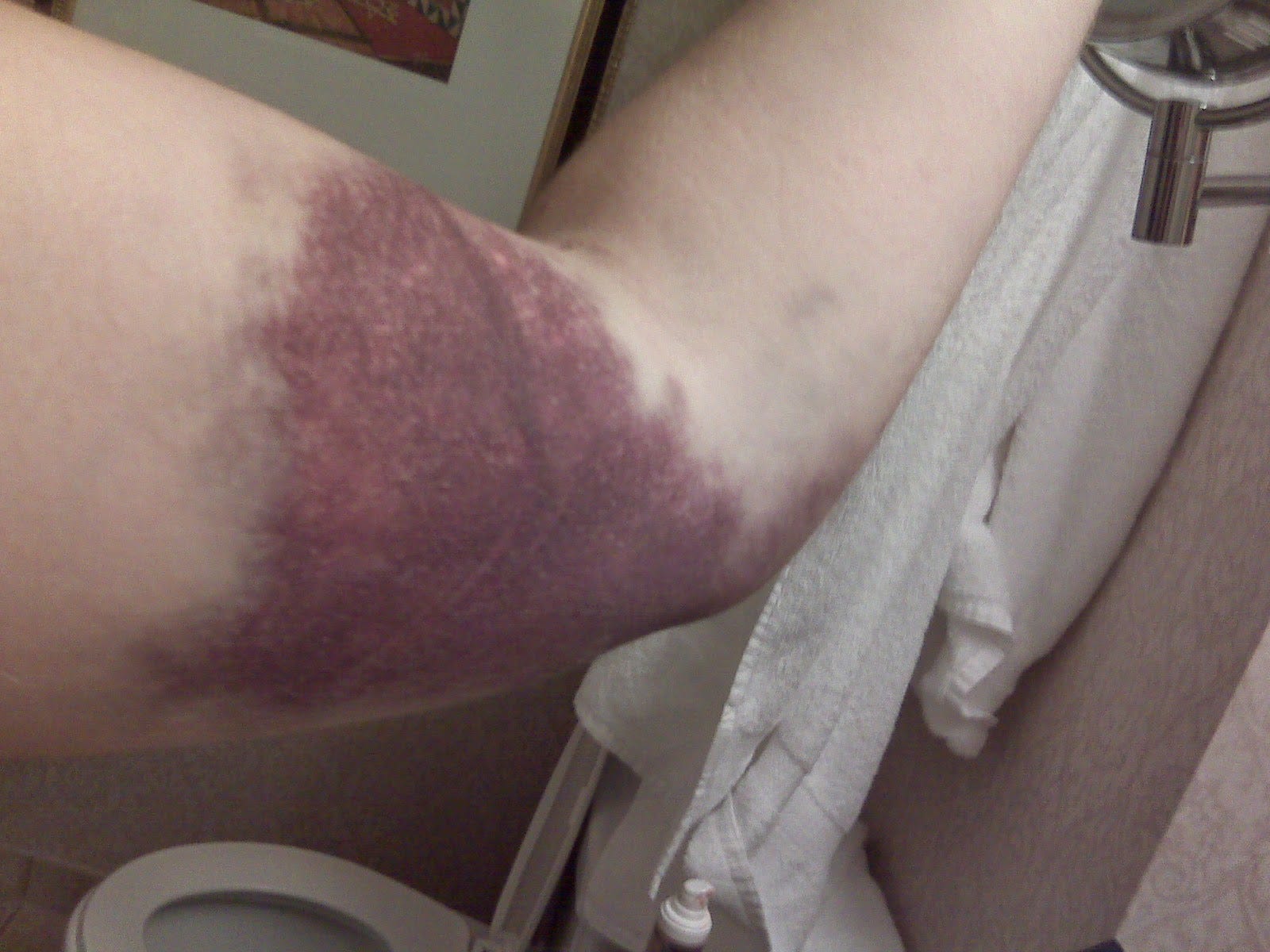 Is it bad donating plasma: main illustration