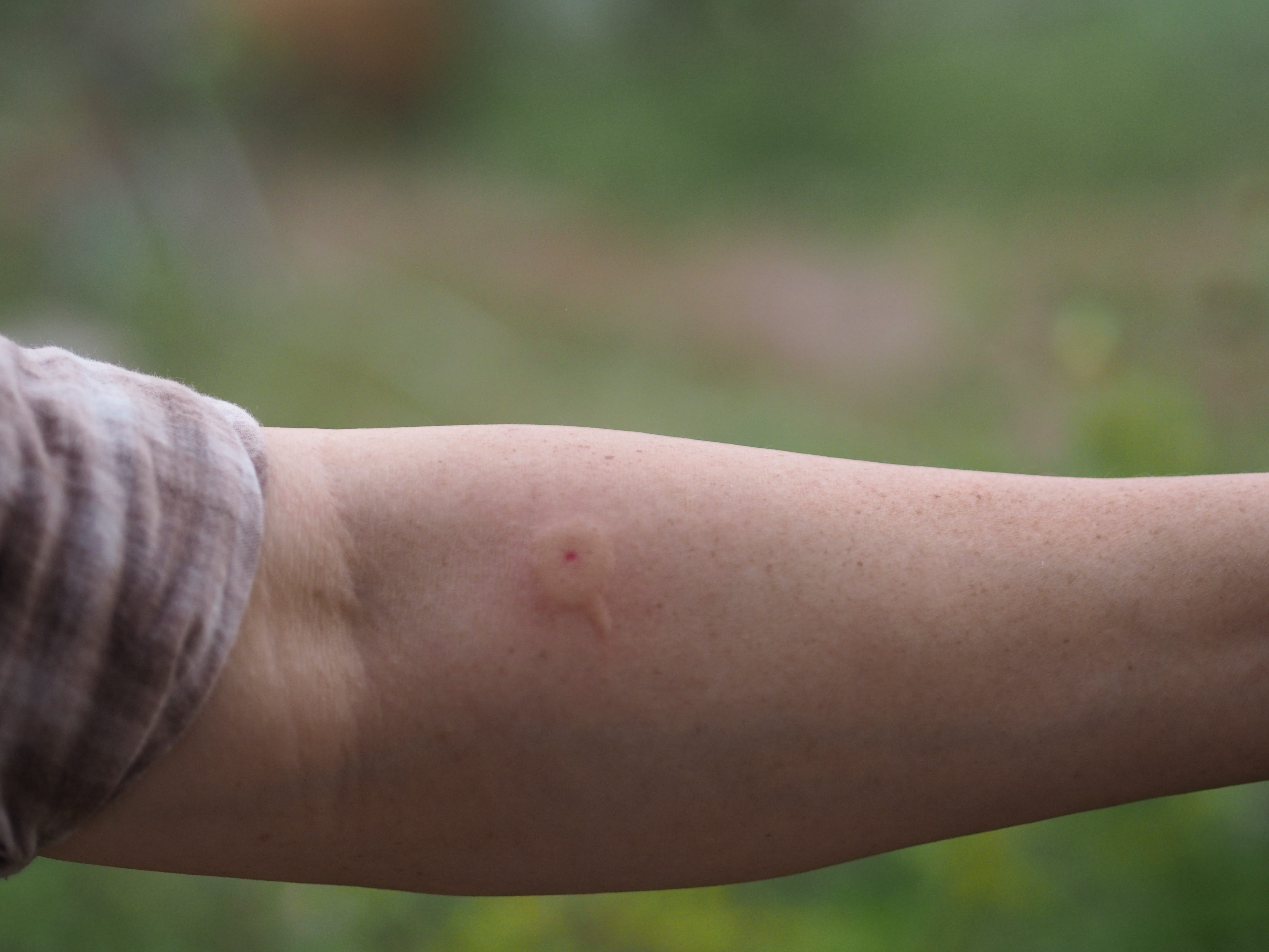 Can normal ants bite: example and key details