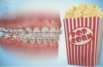 popcorn-Post-art