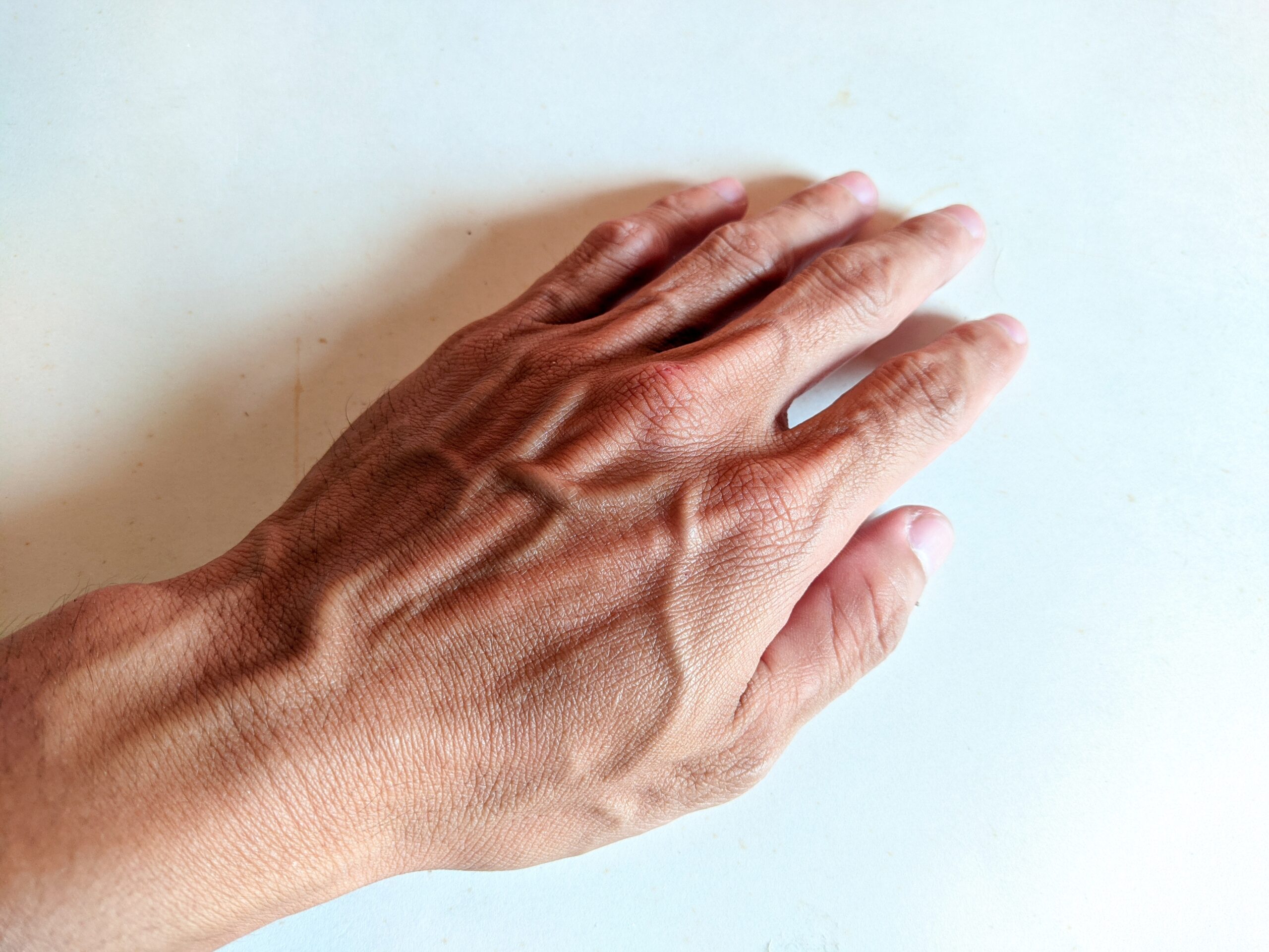 Why do the veins in my hand pop out: main illustration