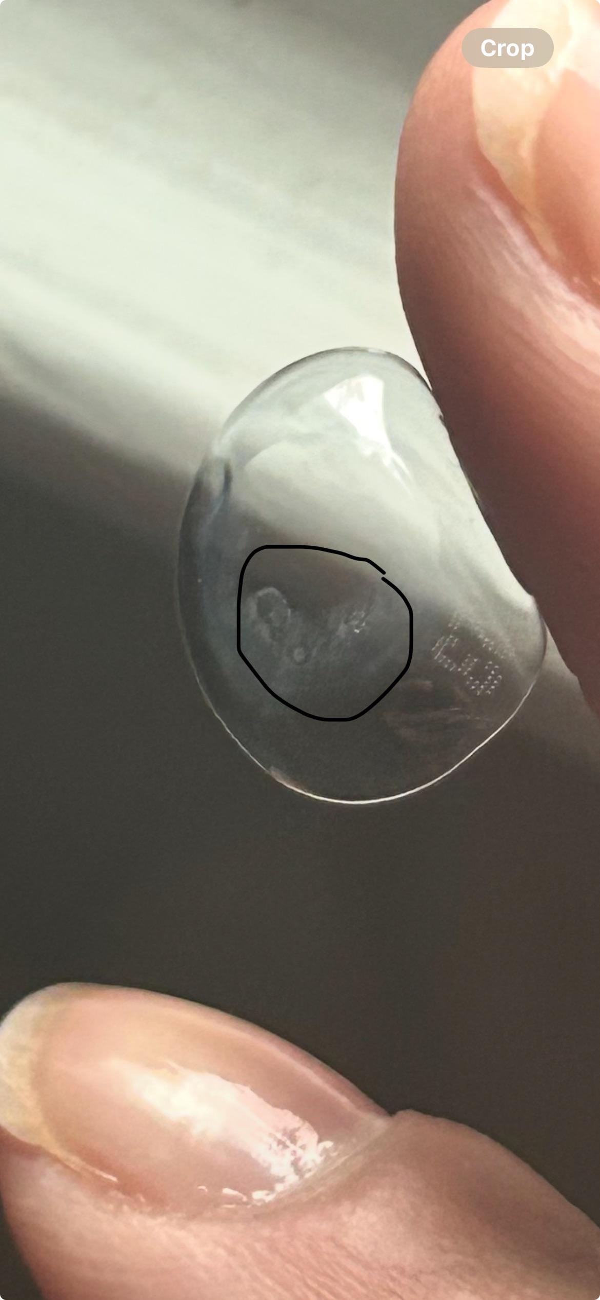 Why does my contact lens get blurry: main illustration