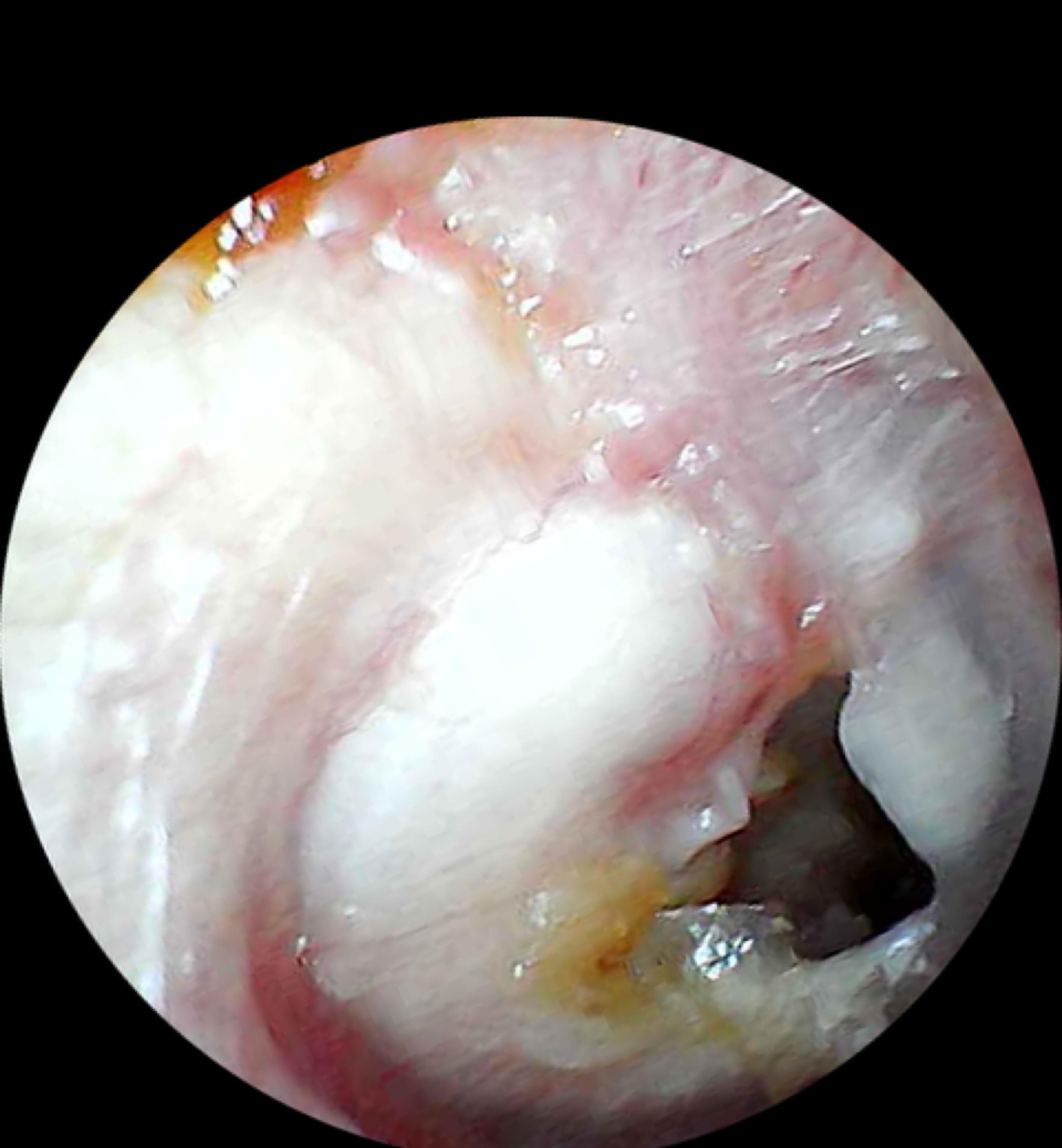 Why does ear wax smell: main illustration